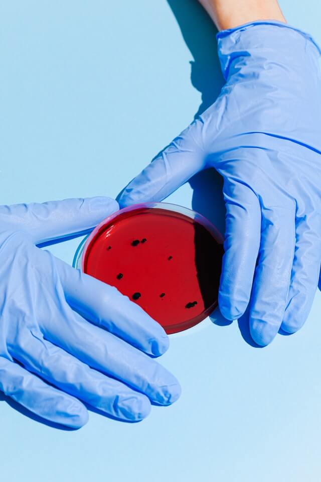 Diagnostic Lab Sampling
